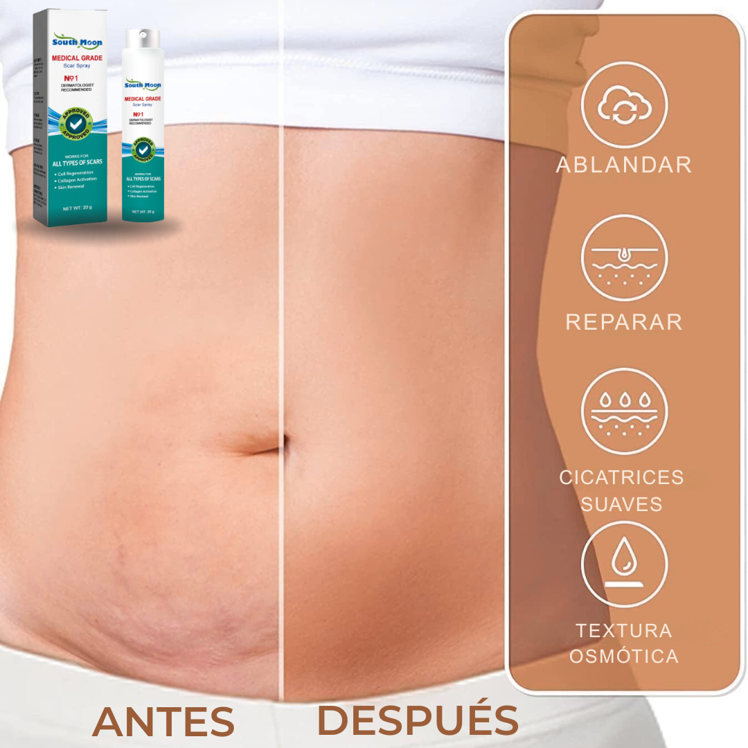 SouthMoon Spray™ | Recupera Tu Confianza